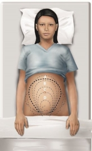The nurse is evaluating the fundal height of a patient who is 20 weeks pregnant. Which height should the nurse expect to assess in this patient?   A)  A B)  B C)  C D)  D