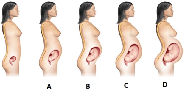 A patient at 28 weeks' gestation asks the nurse why she has backaches. To help explain the changes, the nurse shows her a picture of the shape of her back. Which picture should the nurse use?   A)  A B)  B C)  C D)  D