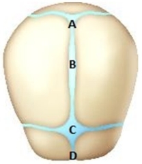 The nurse is reviewing educational material on newborn care with a patient in the 3<sup>rd</sup> trimester of pregnancy. Which area on the following diagram should the nurse point out as being the anterior fontanelle?   A)  A B)  B C)  C D)  D