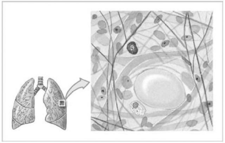 <strong>  Figure 4-4 Connective Tissue Use Figure 4-4 to answer the following question: The type of connective tissue shown in the figure is the least specialized in adults.What is its primary function?</strong> A)It cushions organs and provides support but permits independent movement. B)It provides a storage of energy resources. C)It provides firm attachment of muscles to bone,and conducts the pull of muscles. D)It provides insulation. E)It provides strength to resist forces applied from many directions. <div style=padding-top: 35px> 