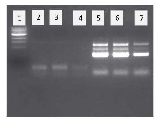 Which of the following choices most likely lists the sizes of the four DNA fragments in lane 6 (from top to bottom) of this agarose gel stained with ethidium bromide? (Note: The well that the DNA was loaded into is at the top of the gel image.)    A) 600 bp,450 bp,300 bp,100 bp B) 100 bp,300 bp,450 bp,600 bp C) 400 bp,300 bp,600 bp,100 bp D) 300 bp,400 bp,100 bp,600 bp E) DNA fragment size can't be estimated using an agarose gel.