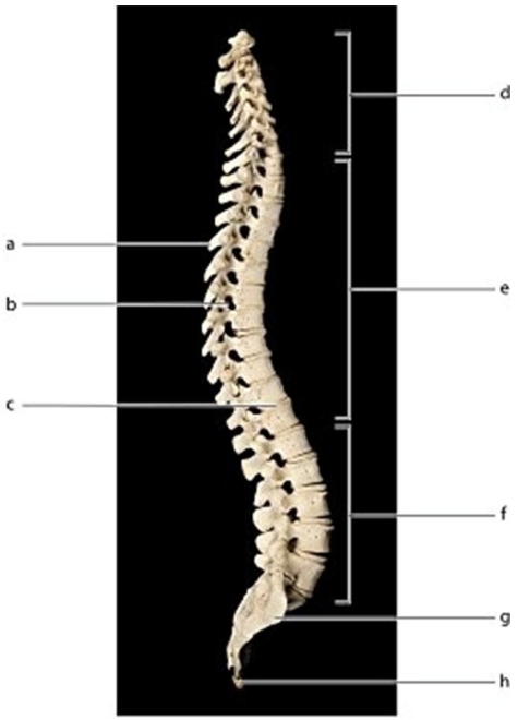   -What is labeled  e ? A) Thoracic curvature B) Sacral curvature C) Lumbar curvature D) Cervical curvature