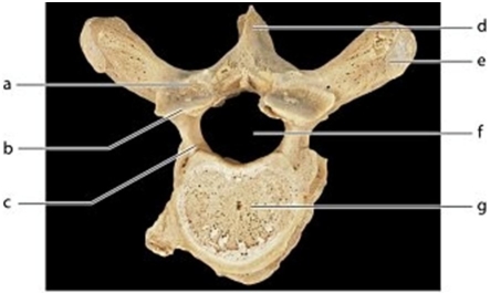   -Identify the bone marking labeled  c.  A) Spinous process B) Pedicle C) Costal facet D) Lamina