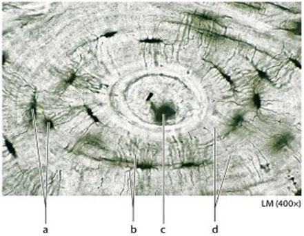   -What is the function of the structure labeled  b ? A) Houses the osteocytes B) Houses cytoplasmic extensions of osteocytes C) Stores the calcium mineral salts D) Transports blood along the length of the osteon