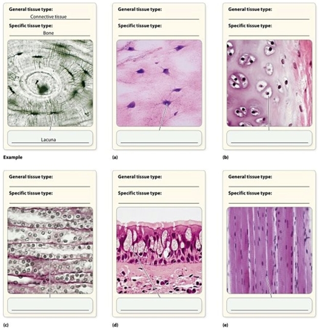   -Which card shows a tissue containing ciliated cells and goblet cells? A) B B) A C) D D) E E) C