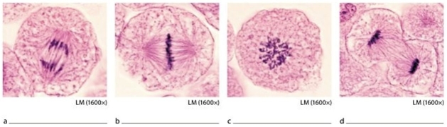   -Which image corresponds to metaphase? A) A B) B C) C D) D