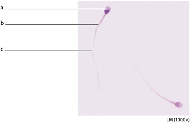   -What type of cell is shown in this image? A) Neuron B) Sperm cell C) Cardiac muscle fiber D) Blood cell