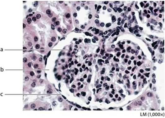   -Identify the structure labeled  a.  A) Renal tubule B) Glomerular capillaries C) Glomerular capsule D) Capsular space