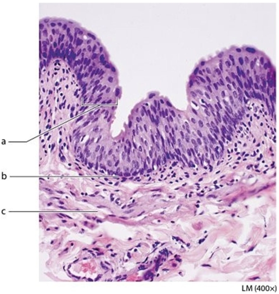   -What tissue type is found in the structure labeled  a ? A) Simple squamous epithelium B) Stratified squamous epithelium C) Transitional epithelium D) Areolar connective tissue
