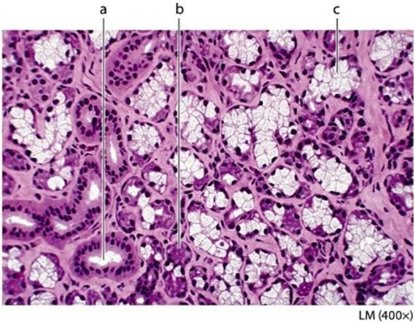   -Identify the structure labeled  a  in the photomicrograph. A) Serous acinus B) Mucous acinus C) Duct D) Acinar cell