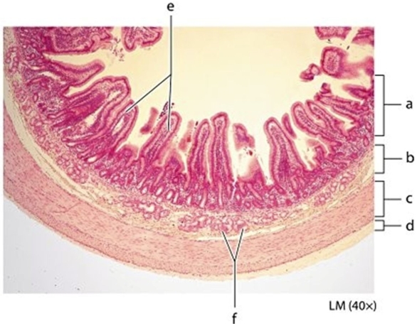   -Identify the layer labeled  b  in the photomicrograph. A) Serosa B) Mucosa C) Submucosa D) Muscularis