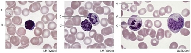   -Identify the formed element labeled  a.  A) Platelet B) Eosinophil C) Lymphocyte D) Erythrocyte