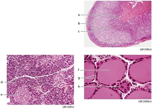   -Identify the structure on the micrograph labeled  a.  A) Zona glomerulosa B) Zona fasciculata C) Acinar cells D) Zona reticularis