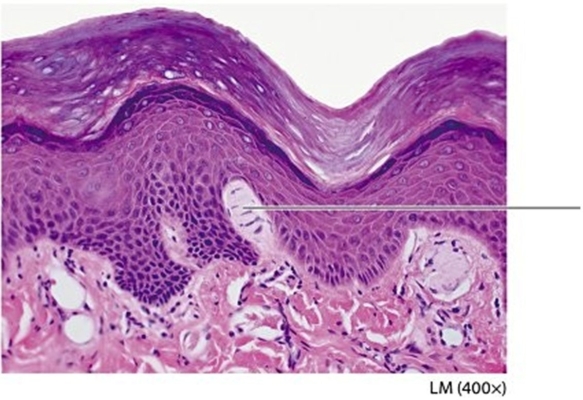   -Examine the cutaneous receptor indicated by the pointer. What is the name of this structure? A) Lamellated (Pacinian) corpuscle B) Tactile (Meissner's) corpuscle C) Ruffini ending D) Merkel cell