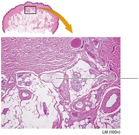   -Examine the cutaneous receptor indicated by the pointer. What is the name of this cutaneous receptor? A) Ruffini ending B) Tactile (Meissner's) corpuscle C) Merkel cell D) Lamellated (Pacinian) corpuscle
