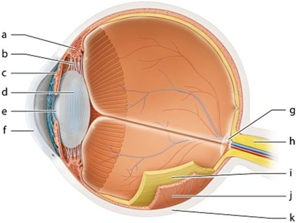   -Identify the structure labeled  a.  A) Ciliary body B) Iris C) Suspensory ligaments D) Lens