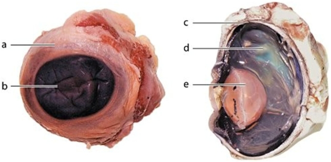   -Identify the structure labeled  b.  A) Sclera B) Choroid C) Cornea D) Lens