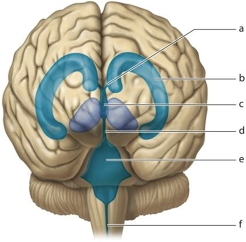   -Identify letter  b.  A) Lateral ventricle B) Fourth ventricle C) Third ventricle D) Interventricular foramen
