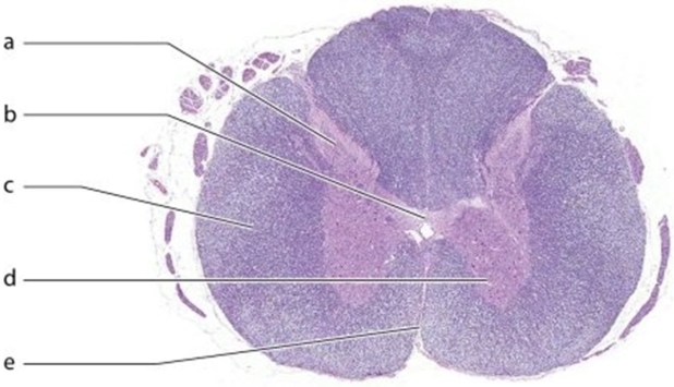   -Identify the structure labeled  e.  A) Lateral funiculus B) Anterior median fissure C) Central canal D) Anterior horn