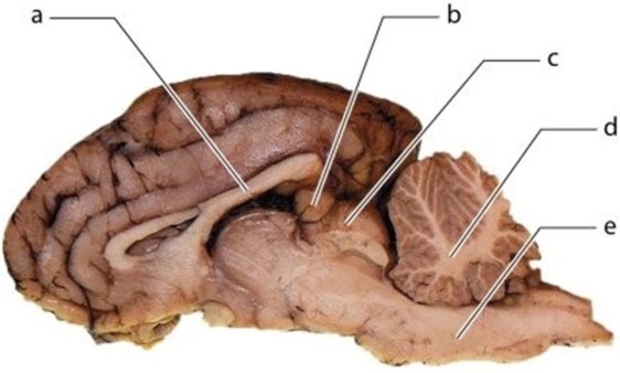   -Identify the structure labeled  c.  A) Corpus callosum B) Arbor vitae C) Midbrain D) Pons