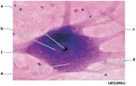   -Which lettered structure marks a neuroglial cell? A) B B) C C) D D) A