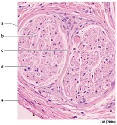   -Letter a is marking the ________. A) perineurium B) axon C) fascicle D) myelin sheath