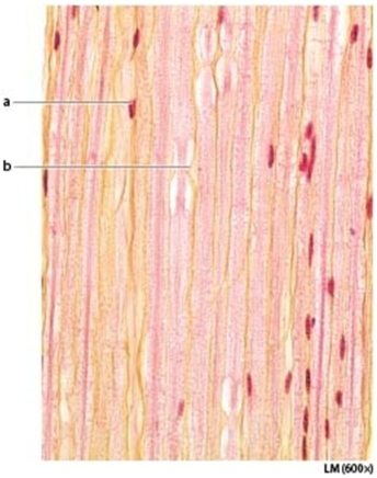   -Letter a is marking the ________. A) neuroglial cell B) axon C) Schwann cell D) nucleus