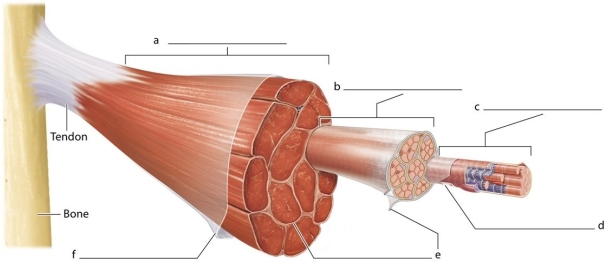   -Which labeled structure is the fascicle? A) A B) B C) C D) D