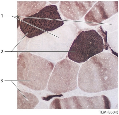   -Which muscle fiber type contains only a few mitochondria because it does not rely on aerobic respiration? A) Slow oxidative (red)  B) Fast oxidative (pink)  C) Fast glycolytic (white) 