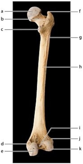   -Identify the bone feature labeled  e.  A) Intercondylar fossa B) Medial condyle C) Lateral epicondyle D) Linea aspera