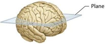   In this figure, the plane of section divides the brain into ________ parts. A) proximal and distal B) superior and inferior C) medial and lateral D) anterior and posterior