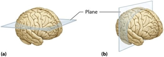   Which plane of section is being demonstrated in figure (b) ? A) Sagittal B) Frontal C) Oblique D) Transverse