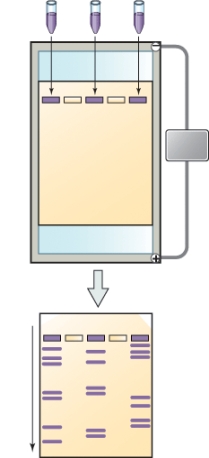 What is the name of the technique shown here?   A)  Karyotype B)  Polymerase chain reaction C)  Human genome project D)  Restriction fragment length polymorphism