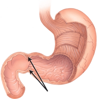 In the diagram, the arrow is pointing at the:   A)  rugae sphincter. B)  duodenal sphincter. C)  esophageal sphincter. D)  pyloric sphincter.