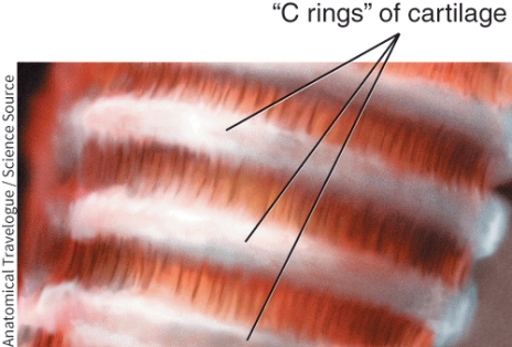 Identify this structure.   A)  Pharynx B)  Esophagus C)  Bronchi D)  Trachea