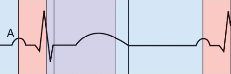 What is happening during the phase labeled A?   A)  Semilunar valve closure B)  AV valve closure C)  Atrial depolarization D)  Ventricular repolarization
