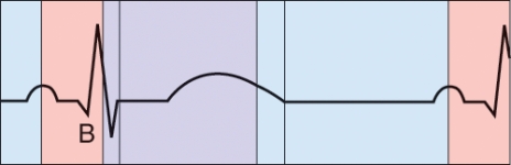 What is happening during the phase labeled B?   A)  Atrial depolarization B)  Ventricular depolarization C)  Ventricular repolarization D)  AV valve closure