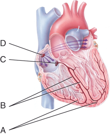 Where is the contraction impulse delayed?   A)  A B)  B C)  C D)  D