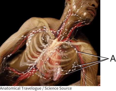 What is the name of the lymphatic structure A?   A)  thymus B)  lymph node C)  spleen D)  tonsil