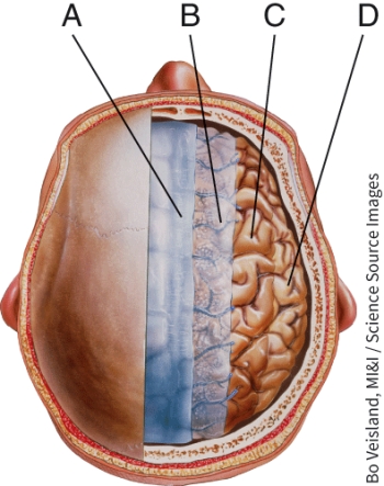 Identify the structure labeled A.   A)  dura mater B)  pia mater C)  arachnoid mater D)  neurons