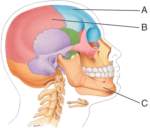 What bone is labeled C?   A)  Maxilla B)  Zygomatic bone C)  Mandible D)  Occipital bone