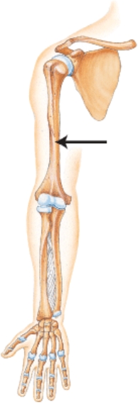 Which bone is indicated by the arrow?   A)  Clavicle B)  Scapula C)  Humerus D)  Ulna