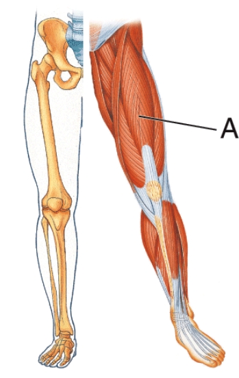 Identify muscle A.   A)  Rectus femoris B)  Semimembranosus C)  Gracilis D)  Sartorius