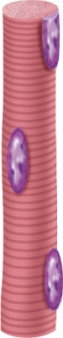In which kind of tissue would you find this?   A)  Cardiac muscle B)  Smooth muscle C)  Skeletal muscle D)  Adipose tissue