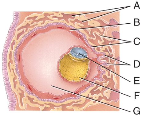 What is line  G  pointing to?   A)  chorion B)  chorionic villi C)  sinusoid D)  extraembryonic mesoderm E)  None of these choices.