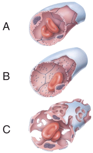 Which type of capillary wall has an incomplete or absent basement membrane?   A)  A B)  B C)  C D)  A and B E)  A, B, and C