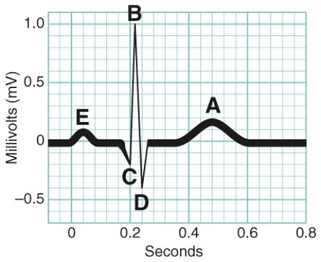 In the figure, which letter indicates the onset of ventricular repolarization?   A)  A B)  B C)  E D)  D E)  C