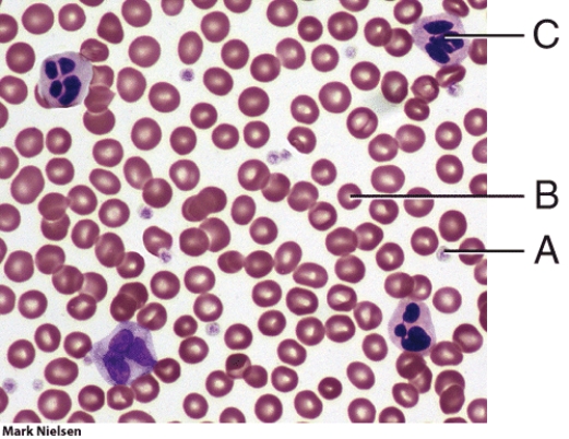 In the figure, which cell is a white blood cell?   A)  A B)  B C)  C D)  both B and C E)  All of these answer choices are correct.