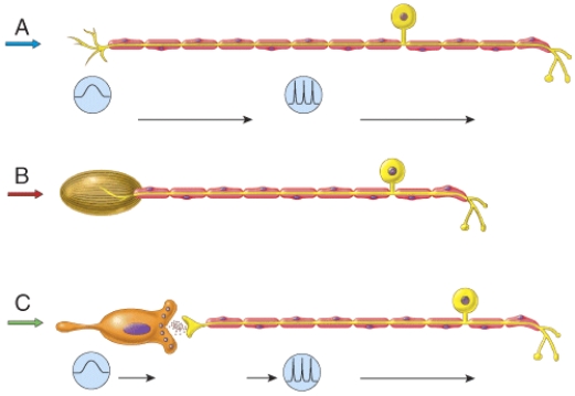 Which of the neurons in the figure would illustrate receptors for pressure and vibration?   A)  A B)  B C)  C D)  both A and B E)  All of these answer choices are correct.