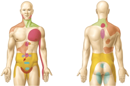 What does the figure represent?   A)  dermatomes B)  areas of referred pain C)  regions of nociceptors D)  areas supplied by the primary somatosensory area E)  areas supplied by the primary motor region